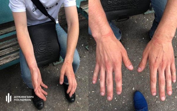 Патрульный, который сломал 17-летнему одесситу, предстанет перед судом: подробности