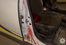Вооруженное нападение на полицейских в Одессе: в каком состоянии патрульные и видео с бодикамер